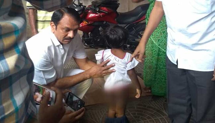 ഭക്ഷണം കഴിക്കവേ നാലുവയസുകാരിയെ അമ്മയും കാമുകനും പൊള്ളിച്ചു ഭക്ഷണം കഴിക്കവേ നാലുവയസുകാരിയെ അമ്മയും കാമുകനും പൊള്ളിച്ചു