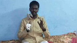 വാവ സുരേഷ് ആശുപത്രി വിട്ടു