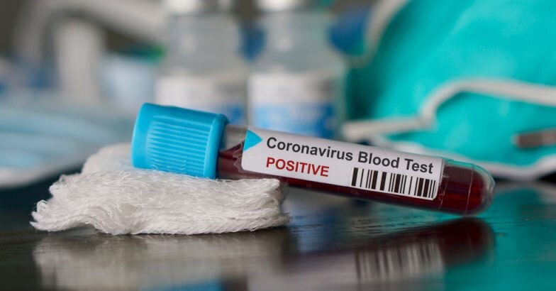 സംസ്ഥാനത്ത് 3966 പേർക്ക് കൂടി കൊറോണ സ്ഥിരീകരിച്ചു; രോഗമുക്തരായത് 4544 പേർ സംസ്ഥാനത്ത് 3966 പേർക്ക് കൂടി കൊറോണ സ്ഥിരീകരിച്ചു; രോഗമുക്തരായത് 4544 പേർ
