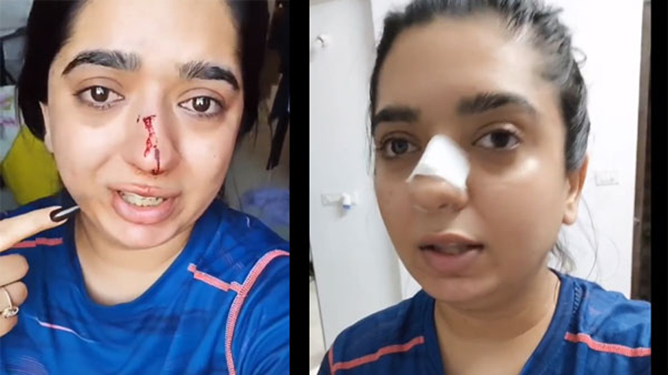 Zomato Case: യുവതി തന്നെ ചെരിപ്പൂരി അടിച്ചെന്ന് സൊമാറ്റോ ഡെലിവറി ബോയി Zomato Case: യുവതി തന്നെ ചെരിപ്പൂരി അടിച്ചെന്ന് സൊമാറ്റോ ഡെലിവറി ബോയി
