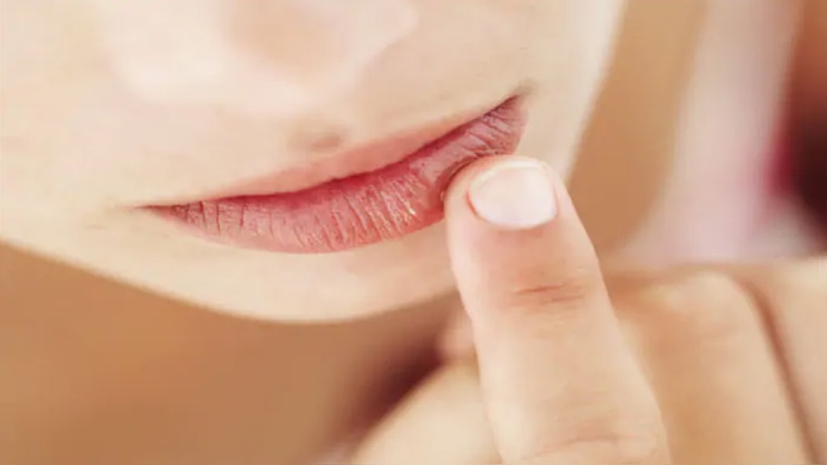 Chapped Lips: ചുണ്ട് വരണ്ട് പൊട്ടുന്നുണ്ടോ? വെളിച്ചെണ്ണ, തേൻ തുടങ്ങി പരിഹരിക്കാൻ 5 വഴികൾ 