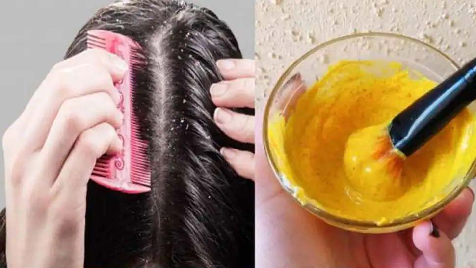 Turmeric Benefits Beauty Tips Turmeric good for hair how to apply