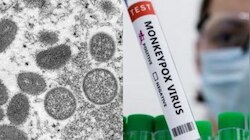 Monkeypox India: യുപിയിൽ സ്ത്രീക്ക് മങ്കിപോക്സ് ലക്ഷണങ്ങൾ; ജാ​ഗ്രത പുലർത്തണമെന്ന് ആരോ​ഗ്യവകുപ്പ്