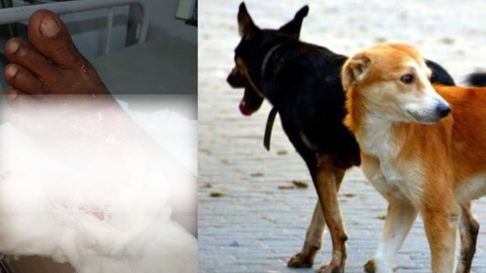 Stray dog attack again in Trivandrum Kerala stray dog issue Stray dog