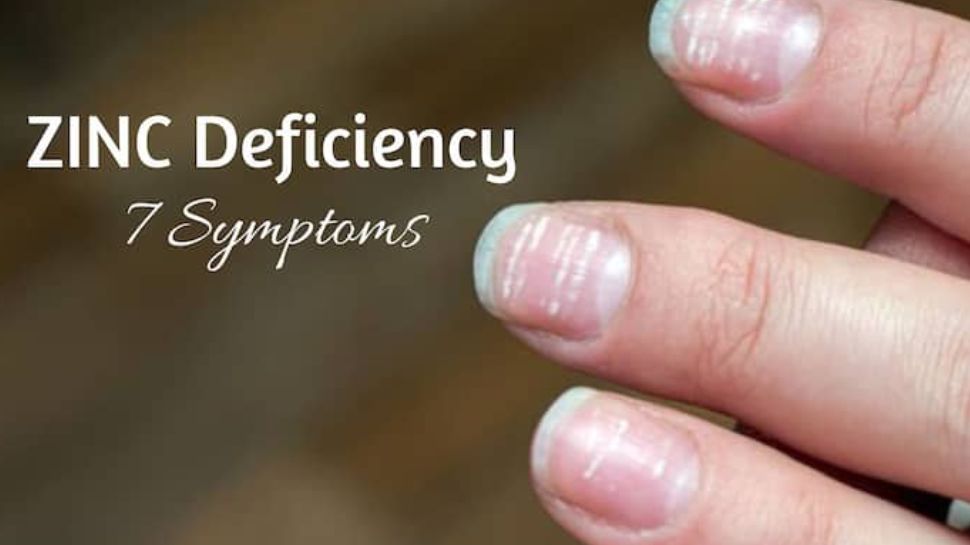 Seven Unusual Symptoms of Zinc Deficiency Gallery Zinc Deficiency