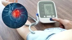High Blood Pressure Diet: രക്തസമ്മർദ്ദമുള്ളവർ ഡയറ്റിൽ ശ്രദ്ധിക്കണം; ഈ ഏഴ് ഭക്ഷണങ്ങൾ രക്തസമ്മർദ്ദം വർധിപ്പിക്കും