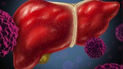 Healthy liver: കരളിനെ ആരോ​ഗ്യത്തോടെ നിലനിർത്താൻ ഈ അഞ്ച് ഭക്ഷണങ്ങൾ കഴിക്കാം