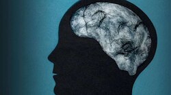 Brain Fog: എന്താണ് ബ്രെയിൻ ഫോ​ഗ്? ലക്ഷണങ്ങളും കാരണങ്ങളും പ്രതിവിധിയും അറിയാം