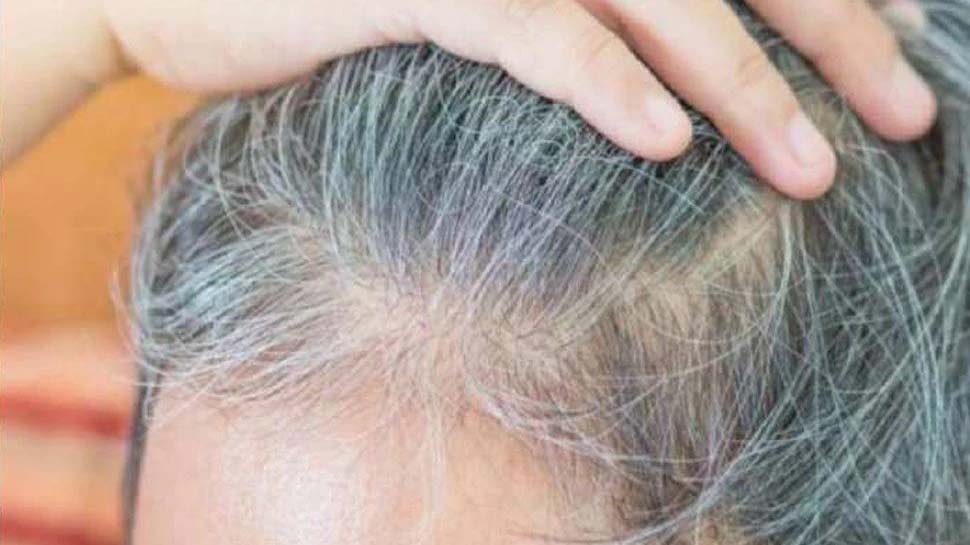 Hair Fall Solution Majic benefits of Sesame seeds for black hair hme