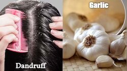 Hair Care: വെളുത്തുള്ളി നീര്, സുന്ദരമായ മുടിയ്ക്കുള്ള അത്ഭുത ടോണിക്ക്  