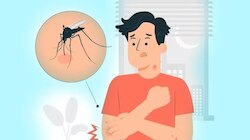 Dengue Fever: ഡെങ്കപ്പനി പരത്തുന്ന കൊതുകുകൾ പകൽ മാത്രമാണോ മനുഷ്യരെ കടിക്കുന്നത്? വാസ്തവം ഇതാണ് 