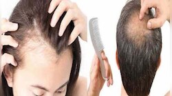 Hair Fall Reason: മുടി കൊഴിയുന്നതിന്‍റെ കാരണം അറിയാമോ? എങ്ങിനെ മുടി കൊഴിച്ചില്‍ തടയാം? 