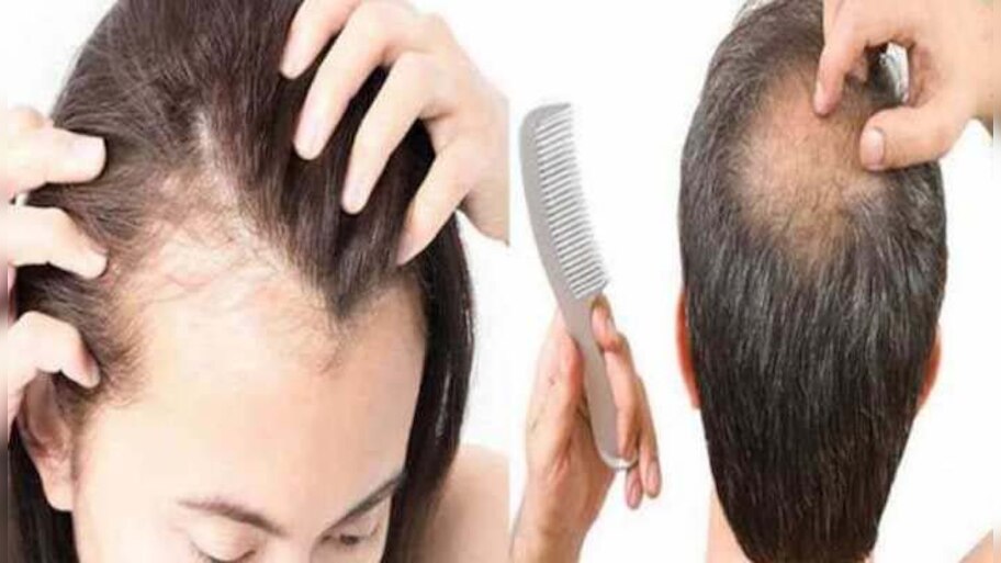 Hair Fall Reason: മുടി കൊഴിയുന്നതിന്‍റെ കാരണം അറിയാമോ? എങ്ങിനെ മുടി കൊഴിച്ചില്‍ തടയാം? 