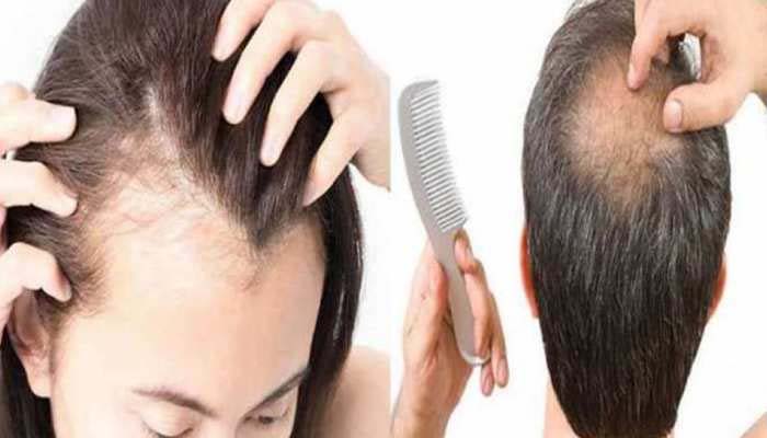 Hair Fall Reason: മുടി കൊഴിയുന്നതിന്റെ കാരണം അറിയാമോ? എങ്ങിനെ മുടി കൊഴിച്ചില് തടയാം? Hair Fall Reason: മുടി കൊഴിയുന്നതിന്റെ കാരണം അറിയാമോ? എങ്ങിനെ മുടി കൊഴിച്ചില് തടയാം?