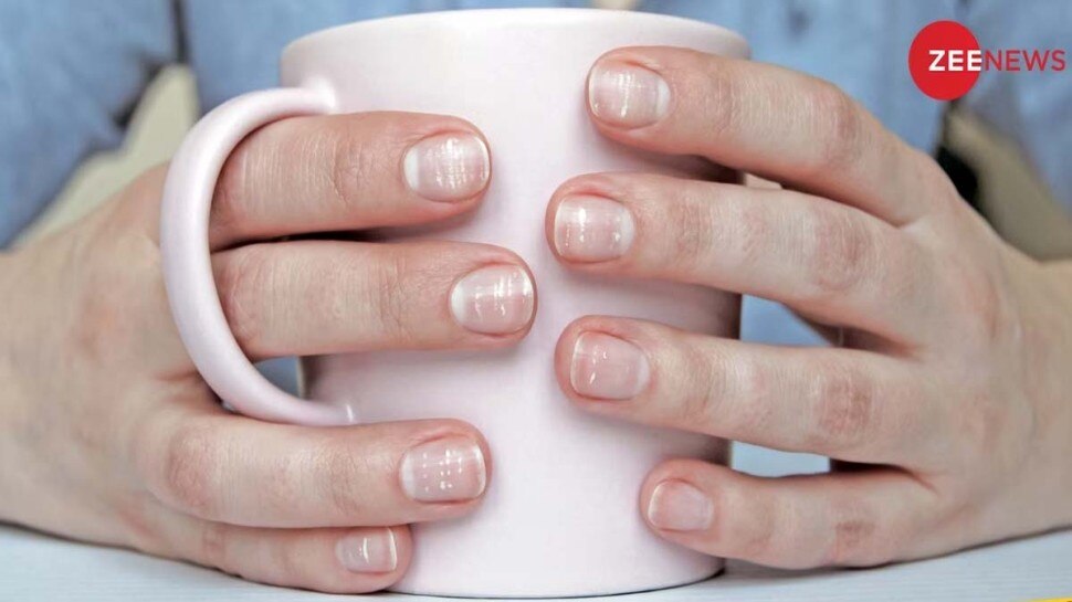 HowNails indicate the the deficiency of Vitamin B12 in your body? Know the symptoms Vitamin