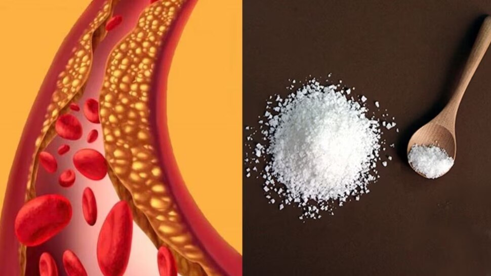 White Salt: വെളുത്ത ഉപ്പ് കൊളസ്ട്രോൾ ഉണ്ടാക്കും..! പകരം ഈ ഉപ്പ് ഉപയോഗിക്കൂ White Salt: വെളുത്ത ഉപ്പ് കൊളസ്ട്രോൾ ഉണ്ടാക്കും..! പകരം ഈ ഉപ്പ് ഉപയോഗിക്കൂ