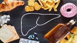 Liver Health: മദ്യം മാത്രമല്ല... ഈ 5 ഭക്ഷണങ്ങളും കരളിനെ തകരാറിലാക്കും!