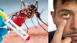 Dengue Fever Alert: ചൂടിന് ശമനം നൽകി വേനൽമഴ; എന്നാൽ, ഡെങ്കിപ്പനിയും മഞ്ഞപ്പിത്തവും വെല്ലുവിളി, മുൻകരുതൽ വേണമെന്ന് ആരോ​ഗ്യവകുപ്പ്