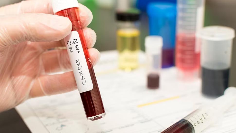 Bengaluru Cholera Outbreak : ജലക്ഷാമത്തിന് പിന്നാലെ ബെംഗളൂരുവിൽ കോളറ വ്യാപനം; 50 ഓളം പേർക്ക് രോഗം സ്ഥിരീകരിച്ചു Bengaluru Cholera Outbreak : ജലക്ഷാമത്തിന് പിന്നാലെ ബെംഗളൂരുവിൽ കോളറ വ്യാപനം; 50 ഓളം പേർക്ക് രോഗം സ്ഥിരീകരിച്ചു