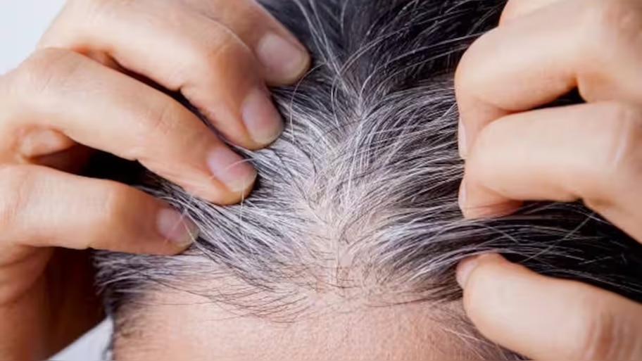 Hair Care: നരച്ച മുടി കറുക്കും! ഉള്ളിനീരിൽ ഇത് മിക്സ് ചെയ്യൂ...