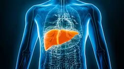 Fatty Liver: ഫാറ്റി ലിവർ വില്ലൻ... ശ്രദ്ധിക്കണം ഇക്കാര്യങ്ങൾ