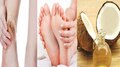 Cracked heels: പാദങ്ങളുടെ വിണ്ടു കീറൽ നിങ്ങളെ അലട്ടാറുണ്ടോ? പരിഹാരം വീട്ടിൽ തന്നെയുണ്ട്!