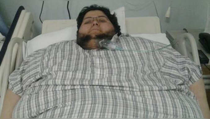 Khalid bin Mohsen Shaari: പത്ത് വർഷത്തിനിടെ 610 കിലോയിൽ നിന്ന് 63.5 കിലോയിലേക്ക്; "സ്മൈലിങ് മാൻ" ആയി മാറിയതിന് പിന്നിൽ സൗദി മുൻ രാജാവ്