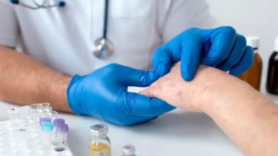 MPox: ഇന്ത്യയിൽ എംപോക്സ് സ്ഥിരീകരിച്ചു; രോ​ഗി ചികിത്സയിൽ, ആരോ​ഗ്യനില തൃപ്തികരം