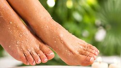 Tan removal remedies: പാദങ്ങൾ കരുവാളിച്ചോ? മാറ്റിയെടുക്കാം ഈ സിംപിൾ ടിപ്സിലൂടെ