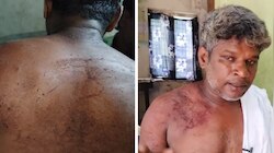 ഉത്സവഘോഷയാത്ര കഴിഞ്ഞ് മടങ്ങവെ യുവാവിന് പോലീസിന്റെ ക്രൂരമർദ്ദനം; പരാതി നൽകി