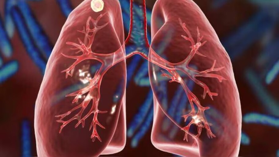 Tuberculosis: ക്ഷയരോഗത്തെ തുടച്ചു നീക്കാൻ ഒരുമിച്ചുള്ള പ്രവർത്തനം അനിവാര്യമെന്ന് ആരോഗ്യ മന്ത്രി വീണാ ജോർജ്