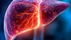 Liver Health Precautions: കരള്‍ അടിച്ചുപോകാന്‍ വെള്ളമടിക്കണം എന്നില്ല... ഈ ശീലങ്ങള്‍ ഒന്ന് ശ്രദ്ധിക്കൂ