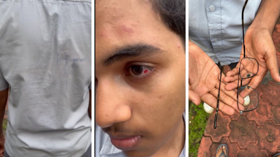 Crime News: യൂണിഫോമിൽ കുത്തിവരച്ചത് ചോദ്യം ചെയ്തു; പ്ലസ് ടു വിദ്യാർത്ഥിക്ക് സഹപാഠികളുടെ ക്രൂരമർദ്ദനം Crime News: യൂണിഫോമിൽ കുത്തിവരച്ചത് ചോദ്യം ചെയ്തു; പ്ലസ് ടു വിദ്യാർത്ഥിക്ക് സഹപാഠികളുടെ ക്രൂരമർദ്ദനം
