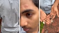 Crime News: യൂണിഫോമിൽ കുത്തിവരച്ചത് ചോദ്യം ചെയ്തു; പ്ലസ് ടു വിദ്യാർത്ഥിക്ക് സഹപാഠികളുടെ ക്രൂരമർദ്ദനം