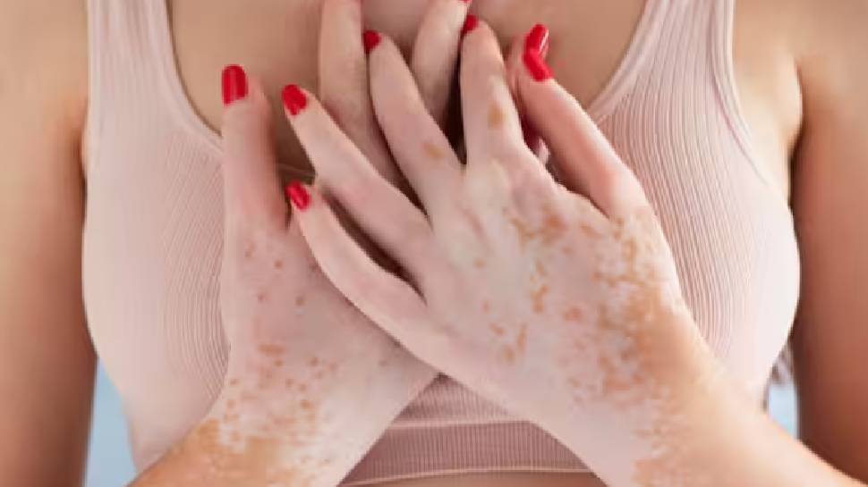  Breast Cancer Symptoms