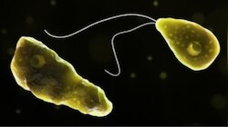 Amoebic meningoencephalitis: തിരുവനന്തപുരത്ത് വയോധികക്ക് അമീബിക് മസ്തിഷ്കജ്വരം സ്ഥിരീകരിച്ചു