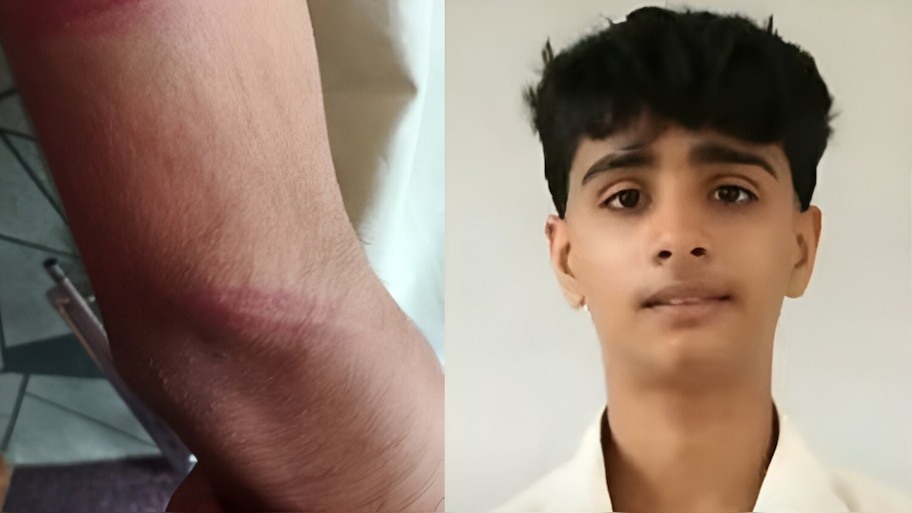 Palakkad Student Death:ഒൻപതാം ക്ലാസുകാരൻ ആത്മഹത്യ ചെയ്ത സംഭവം; അധ്യാപിക മർദിച്ചതിന്  തെളിവുണ്ടെന്ന് കുടുംബം