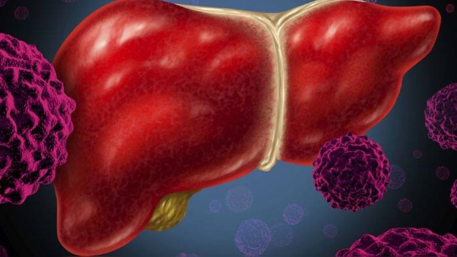 Liver Health: ശരീരം നൽകുന്ന ഈ സൂചനകൾ അവ​ഗണിക്കരുത്! കരളിന്റെ ആരോ​ഗ്യം അപകടത്തിലാകുന്നതിന്റെ ലക്ഷണങ്ങൾ