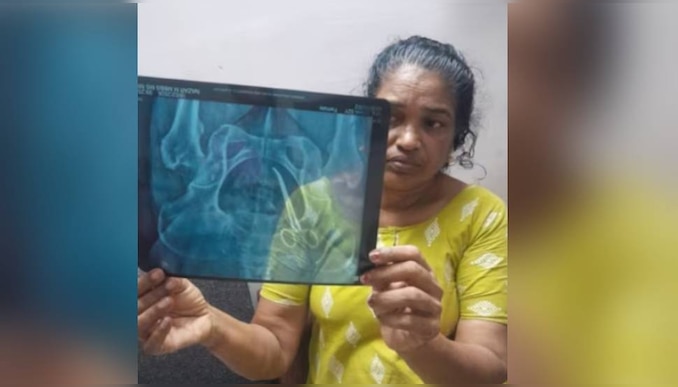 Medical Malpractice Case: 'പെണ്ണായി ജനിച്ച ആരും ഇനി ഈ വേദന അനുഭവിക്കരുത്; ഉഷ ജോസഫ് ആശുപത്രി വിട്ടു