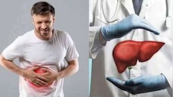 Liver Disease Symptoms: കരൾ അപകടത്തിലാണോ? ശരീരത്തിലെ ഈ മാറ്റങ്ങൾ അവ​ഗണിക്കരുത്, ശ്രദ്ധിക്കണം..!