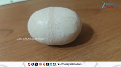 Egg Shell Issue: തോട് വെൽഡ് ചെയ്ത കോഴിമുട്ടയോ?