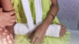 Teacher Beaten Up Student: ക്ലാസിൽ ശ്രദ്ധിക്കുന്നില്ലെന്ന് ആരോപിച്ച് അഞ്ചാം ക്ലാസുകാരിയുടെ കൈ തല്ലി ഒടിച്ചു; അധ്യാപകനെതിരെ കേസ്