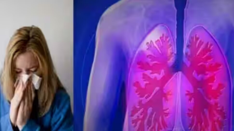 H3N2 Influenza Versus COVID 19 How To Tell The Difference Between The