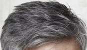 Natural Remedies for Gray Hair: നരച്ച മുടിയാണോ പ്രശ്നം; ഭക്ഷണത്തിൽ ശ്രദ്ധിക്കാം
