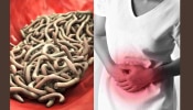 Stomach Worms Symptoms: ഈ ലക്ഷണങ്ങളുണ്ടോ...? വയറിൽ വിര നിറഞ്ഞിട്ടുണ്ടാകാം; പരിഹരിക്കാൻ ഇതാ ചില പൊടിക്കൈകൾ
