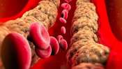 Cholesterol: ചീത്ത കൊളസ്ട്രോൾ കുറയ്ക്കാൻ കഴിക്കൂ ഈ സൂപ്പർ ഫുഡ്സ്