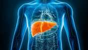 Fatty Liver: ഫാറ്റി ലിവർ വില്ലൻ... ശ്രദ്ധിക്കണം ഇക്കാര്യങ്ങൾ