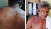 Police Beats Man: ഉത്സവഘോഷയാത്ര കഴിഞ്ഞ് മടങ്ങവെ യുവാവിന് പോലീസിന്റെ ക്രൂരമർദ്ദനം; പരാതി നൽകി