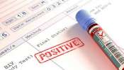 HIV Positive: മലപ്പുറത്ത് ലഹരി സംഘത്തിലുള്ള 9 പേർക്ക് എച്ച്ഐവി ബാധ