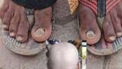 Nail loss in Maharashtra: തലയില്‍ ഒരു മുടി പോലും ബാക്കിയില്ല; ഇപ്പോൾ നഖങ്ങളും തനിയെ കൊഴിയുന്നു; ആശങ്കയില്‍ ഒരു ഗ്രാമം